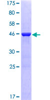 12.5% SDS-PAGE Stained with Coomassie Blue.